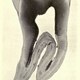 Illustration for article titled 110 Years Ago, These Microscopic Photos Horrified Londoners